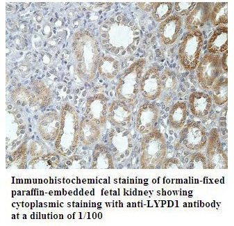 LYPD1 Antibody