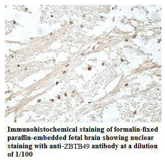 ZBTB49 Antibody