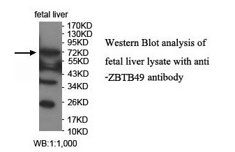 ZBTB49 Antibody