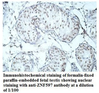 ZNF597 Antibody