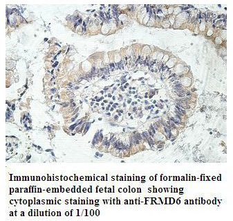 FRMD6 Antibody