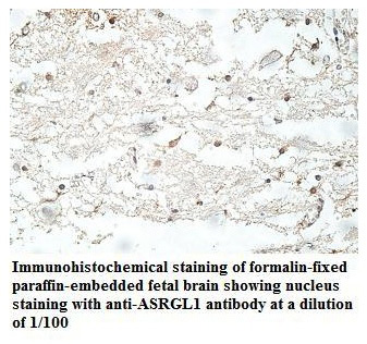 ASRGL1 Antibody