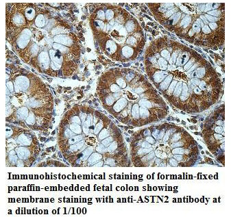 ASTN2 Antibody