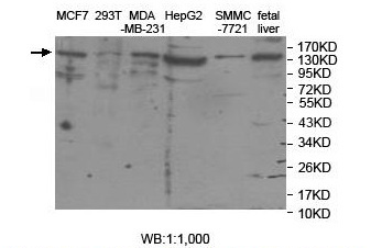 ASTN2 Antibody