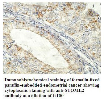 STOML2 Antibody