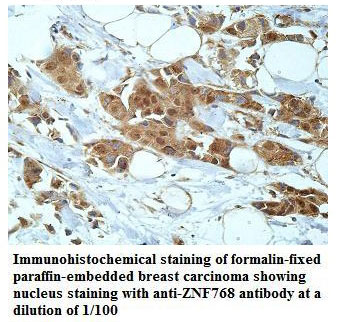 ZNF768 Antibody