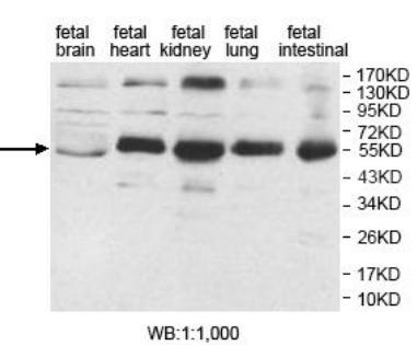 AP1M2 Antibody