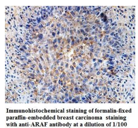  ARAF Antibody