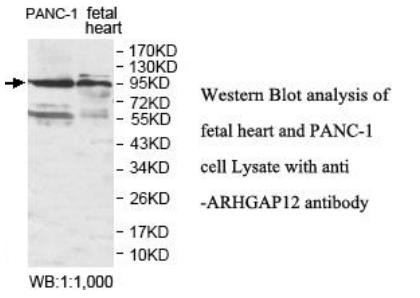 ARHGAP12 Antibody