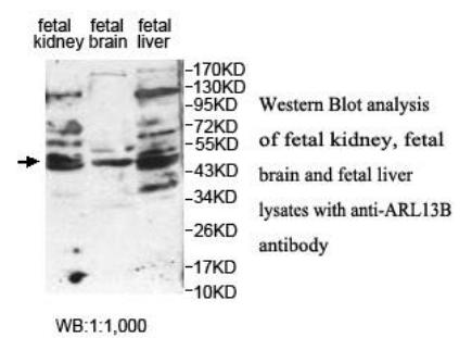 ARL13B Antibody