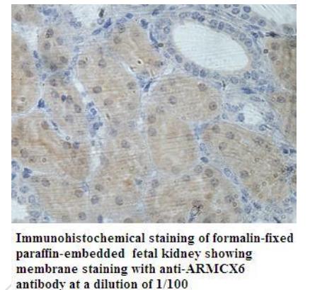 ARMCX6 Antibody