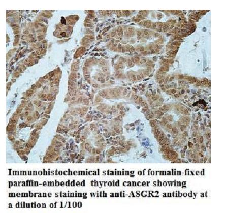 ASGR2 Antibody