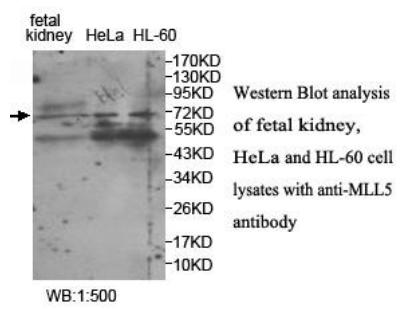 MLL5 Antibody