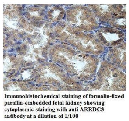 ARRDC3 Antibody