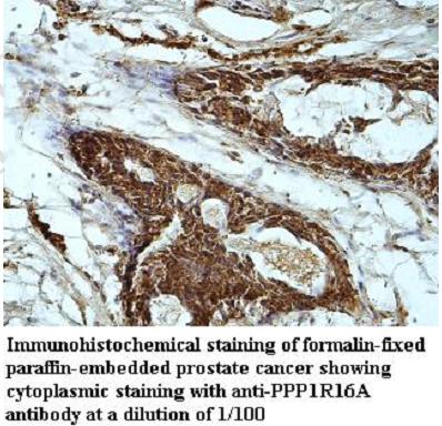 PPP1R16A Antibody