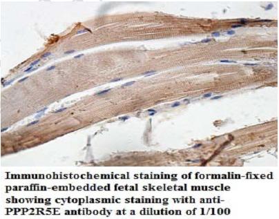 PPP2R5E Antibody