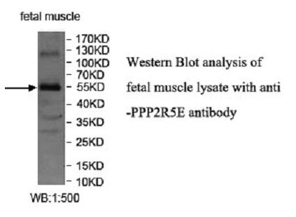 PPP2R5E Antibody