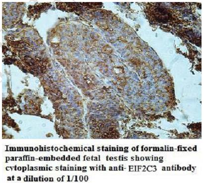 EIF2C3 Antibody