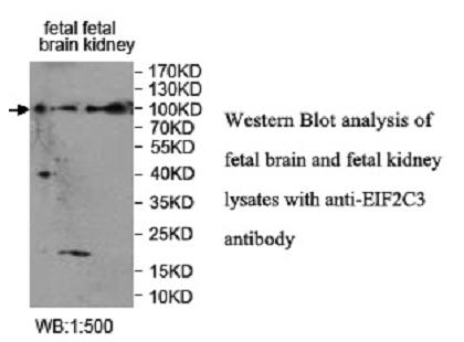 EIF2C3 Antibody