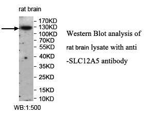 SLC12A5 Antibody