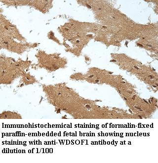 WDSOF1 Antibody