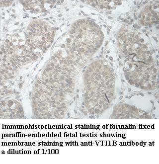 VTI1B Antibody