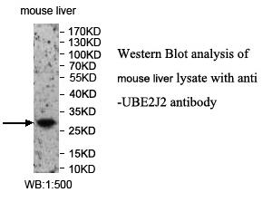 UBE2J2 Antibody