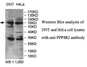 PPP4R2 Antibody