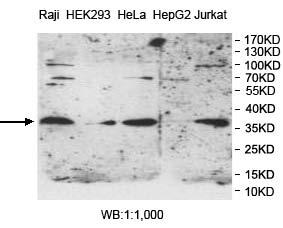 PPT1 Antibody