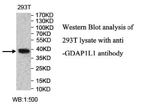 GDAP1L1 Antibody