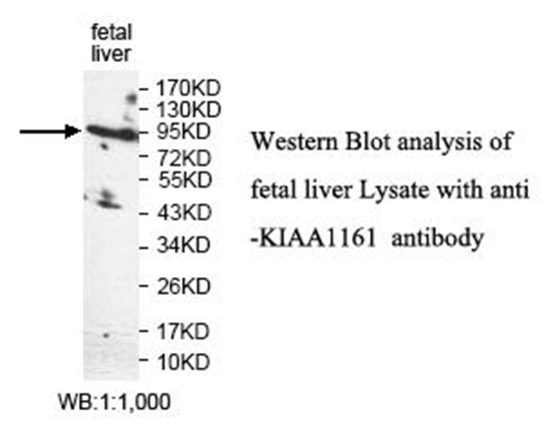 KIAA1161 Antibody