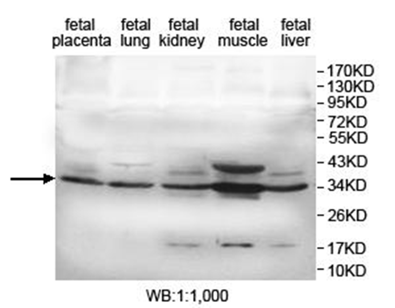 KDSR Antibody