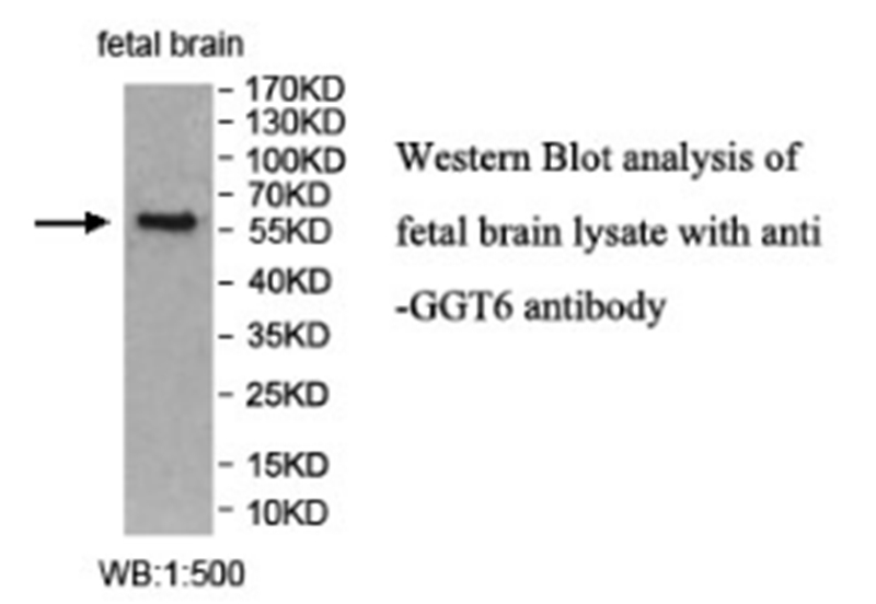 GGT6 Antibody