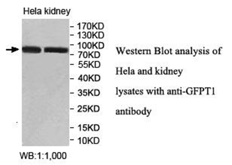 GFPT1 Antibody