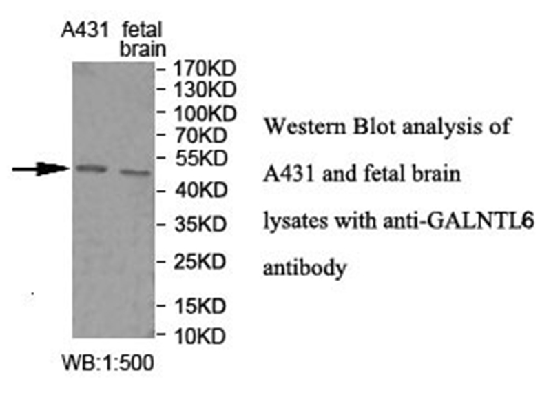 GALNTL6 Antibody