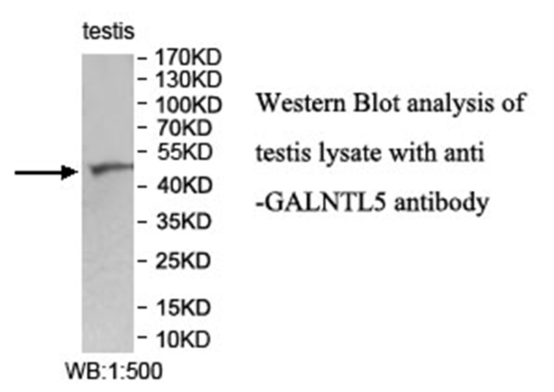 GALNTL5 Antibody