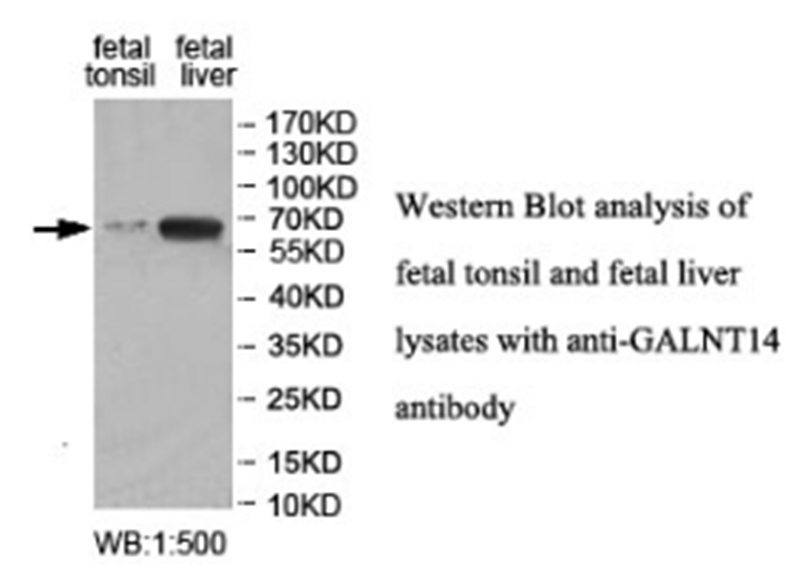 GALNT14 Antibody