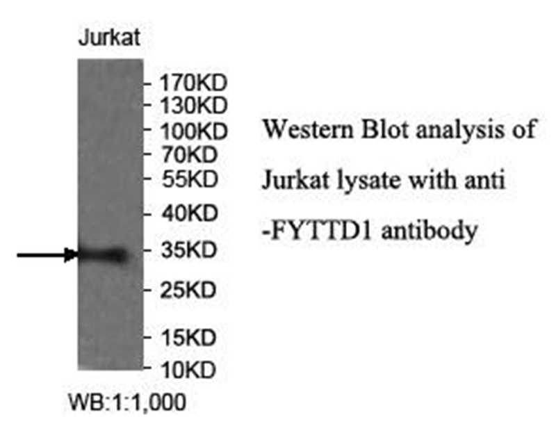 FYTTD1 Antibody