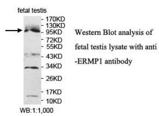 ERMP1 Antibody