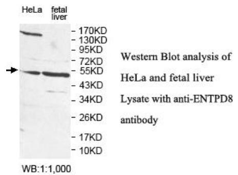 ENTPD8 Antibody