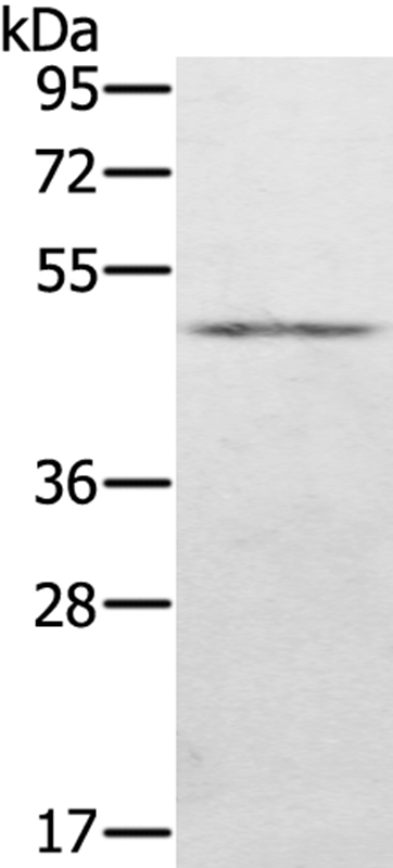 KDM8 Antibody