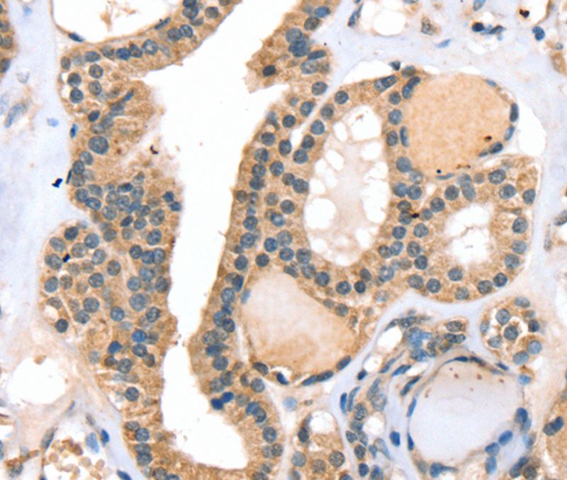 RASGEF1A Antibody