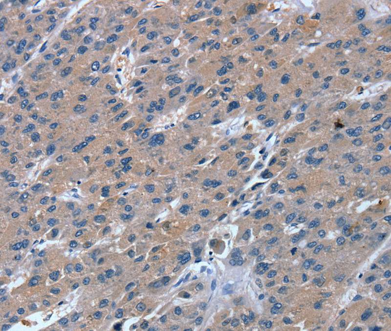 RGS11 Antibody