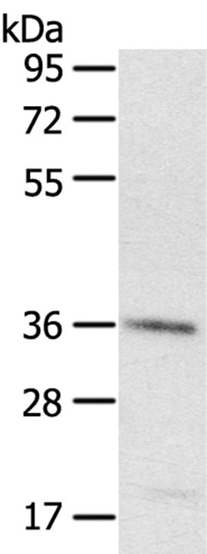 PDLIM4 Antibody