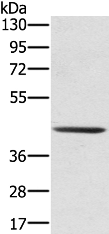 SCPEP1 Antibody