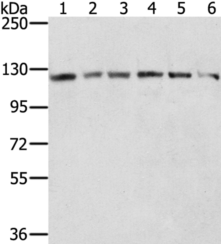 RNF20 Antibody