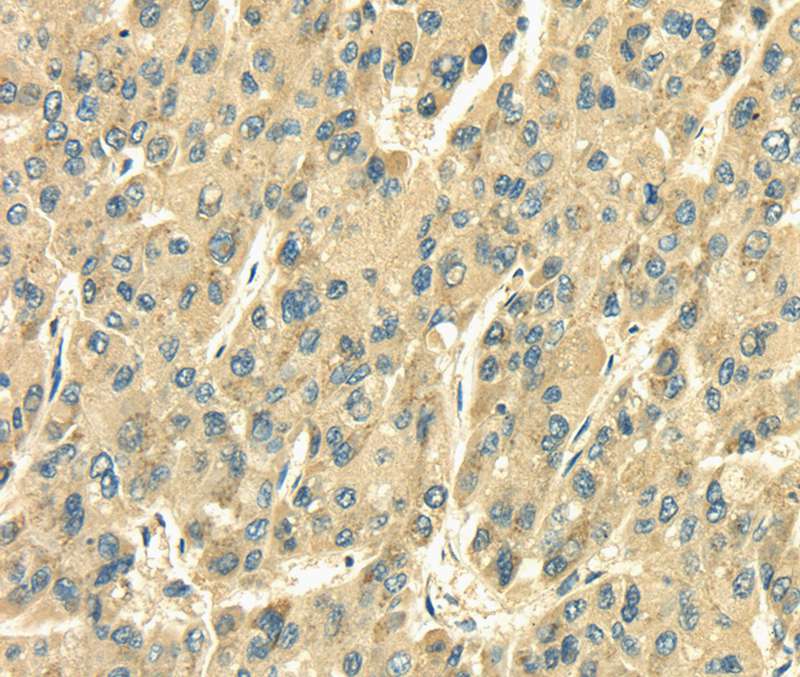 SDF4 Antibody