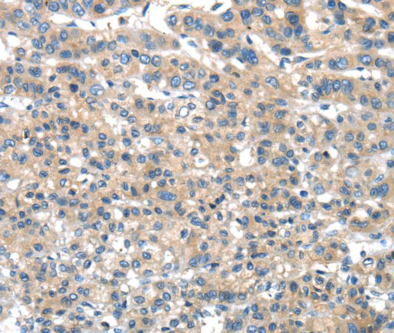 DNAJA3 Antibody