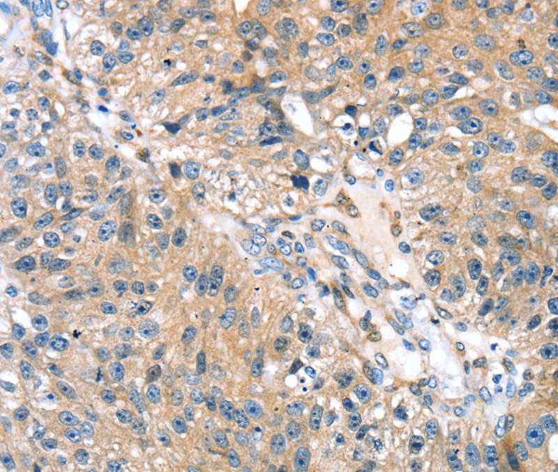 STXBP4 Antibody