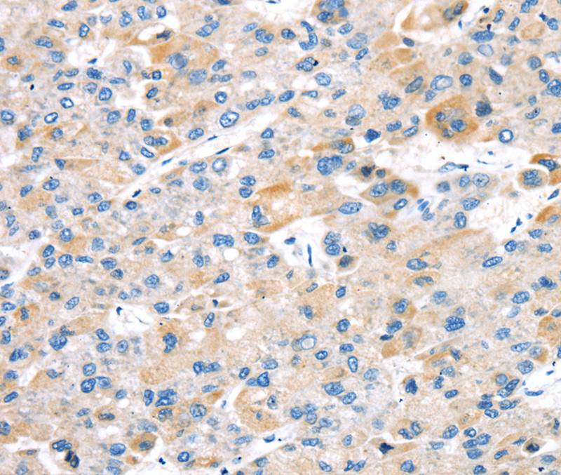 TBRG1 Antibody